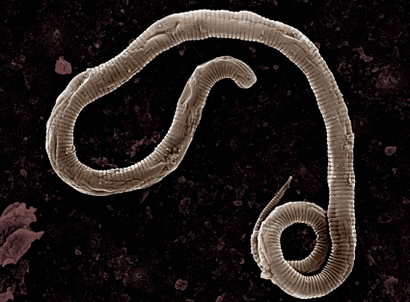 Where the human body worms come from
