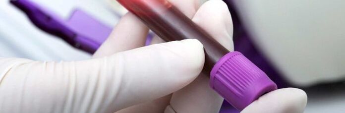 blood for parasite tests