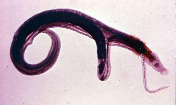Schistosomes are one of the most common and dangerous parasites. 